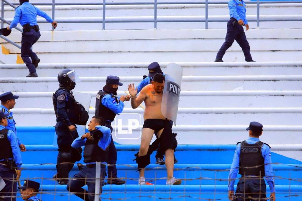 Así quedó este aficionado del Real España que trataba de protegerse de los policías.