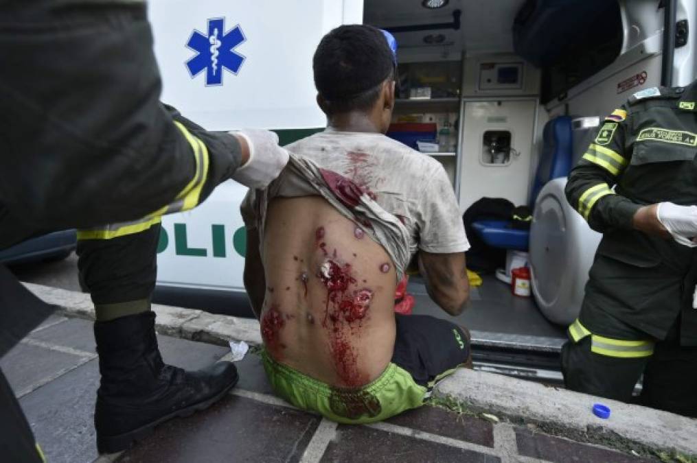 Los violentos choques de esta semana dejaron varios heridos. Uno de los afectados fue golpeado por varios disparos en su brazo, pecho y espalda, lo que provocó que se desangrara. Fue trasladado a un centro médico en Colombia.