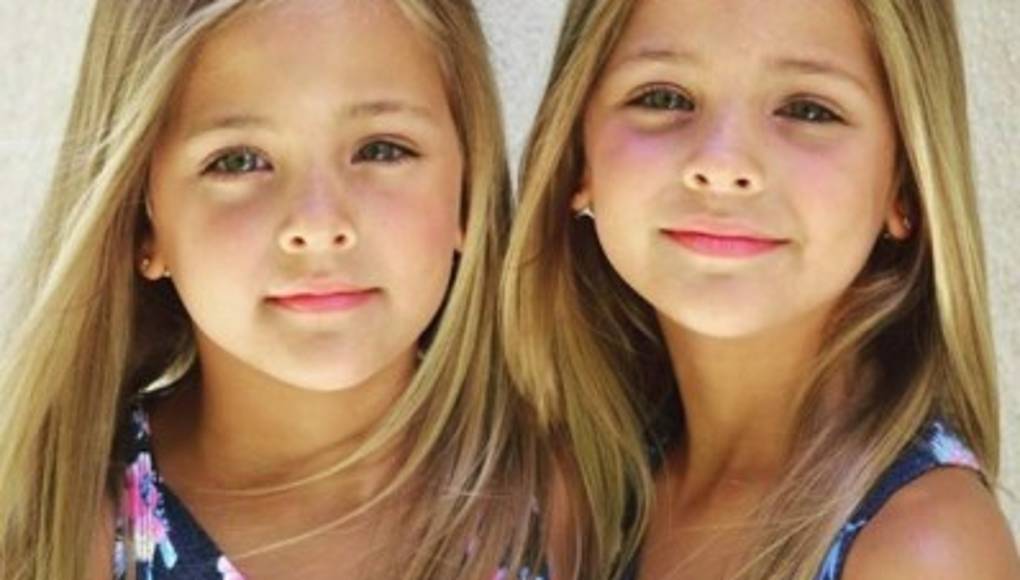 Las gemelas más bellas del mundo