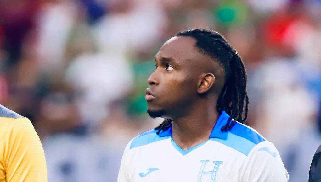 Alberth Elis apareció en la prelista de Honduras, pero su fractura craneal confirma su baja para este compromiso ante los ticos. Nuestro compatriota está pasando un momento duro.