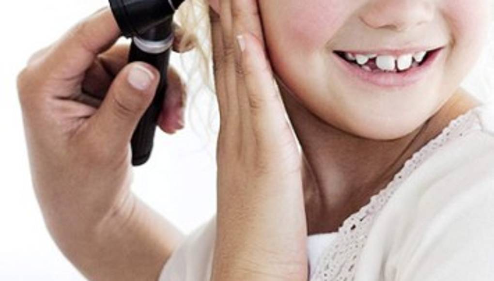 Un balón nasal puede tratar la otitis media exudativa