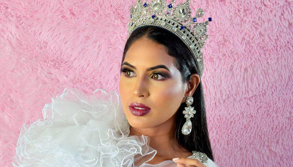 Wilevis Brito felleció poco después de entrar a quirófano para eliminar “un pequeño bulto” que tenía en el labio superior por “motivos de salud”, dijo la familia.