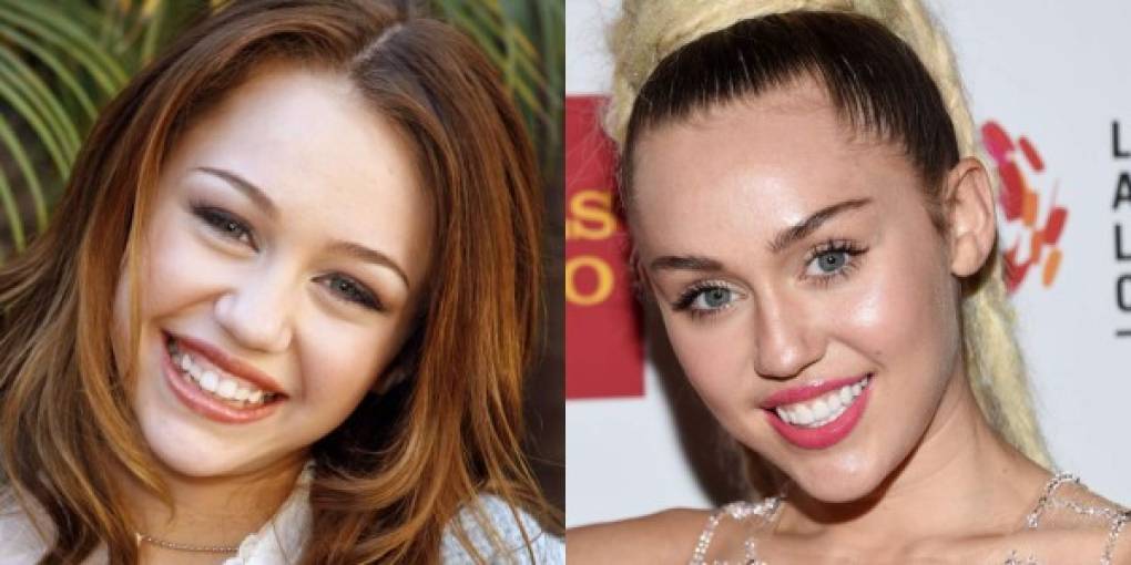 Miley Cyrus no es la misma chica que sonreía tímidamente desde que transformó sus dientes dándoles un aspecto armonioso.