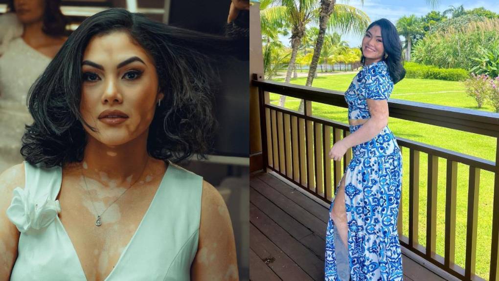 Any Michelle Enamorado cursó el bachillerato, también aspira a continuar sus estudios en la universidad.