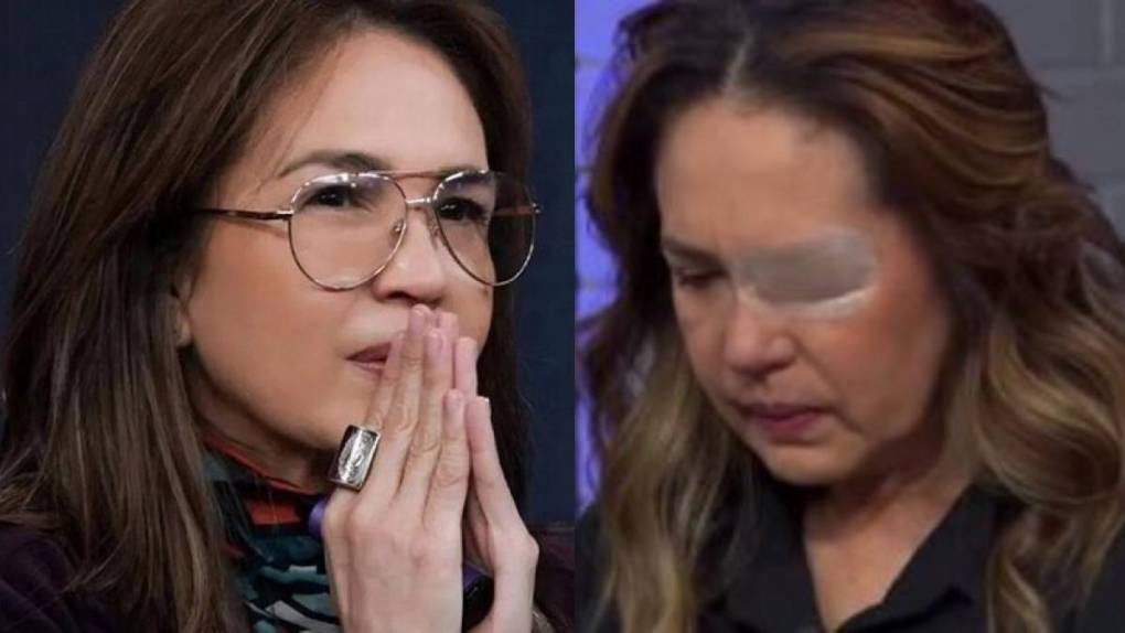 A pesar de las dificultades, Andrade ha mostrado una actitud resiliente. Sin embargo, su estado actual sigue preocupando tanto a sus seguidores como a figuras del medio artístico. En sus publicaciones más recientes, se puede observar que enfrenta complicaciones al articular palabras, evidenciando la gravedad de su condición.