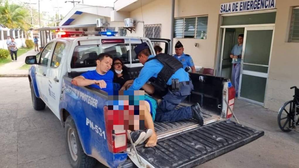Además, uno de los lesionados, en estado muy grave, fue enviado al Hospital Mario Catarino Rivas, de San Pedro Sula, en el norte hondureño.