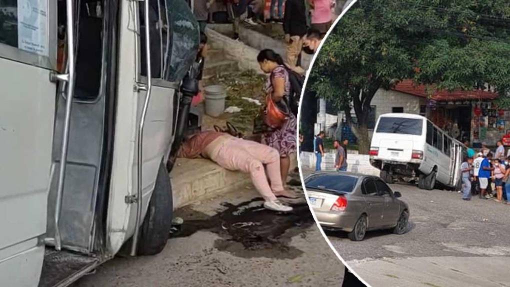 ¡Peleando ruta! Bus rapidito se estrella contra un muro: 10 pasajeros heridos