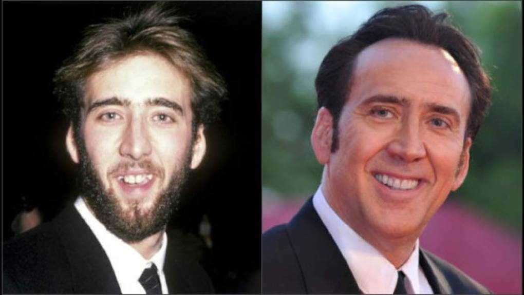 Nicolas Cage.<br/>Uno de los actores más queridos y reconocido mundialmente, Cage tuvo que mejorar la estética de sus dientes, ya que antes lucían amarillentos y le faltaban algunos. Así que tras unos retoques, ahora puede presumir de una dentadura completamente blanca.