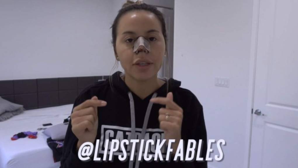 LipstickFables comparte su antes y después de las cirugías