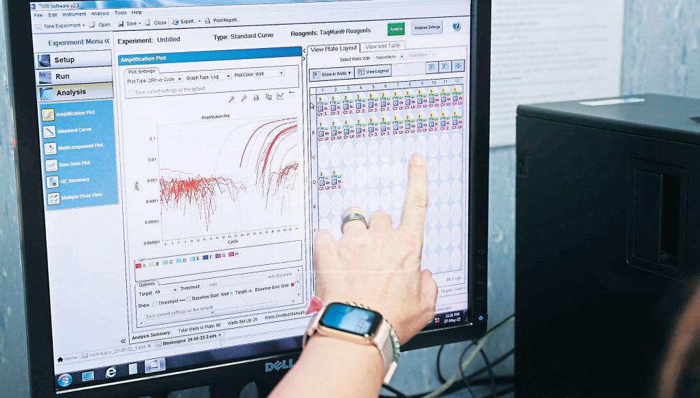 CMH pide a Salud obtener PCR en caso de la llegada de la viruela del mono