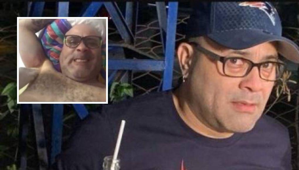 “Quedé con trauma, casi muero”: Gustavo Vallecillo, sobreviviente al ataque de un pitbull