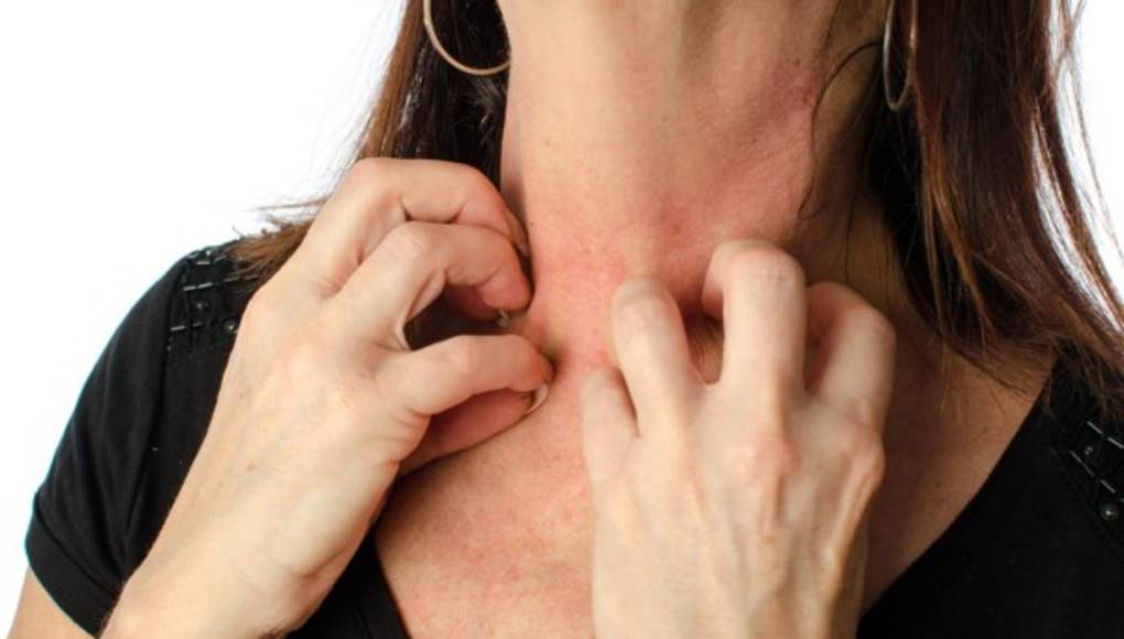 Los científicos obtienen nueva información sobre las alergias