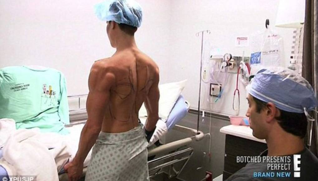 El ‘Ken humano’ se implantó alas para parecerse a un ángel