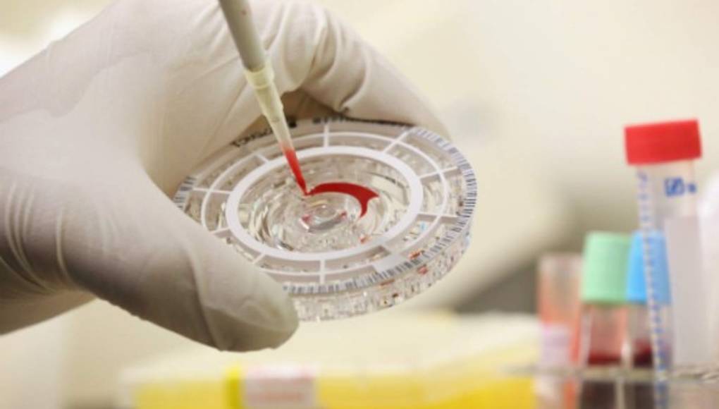 La FDA autoriza test de detección del ébola