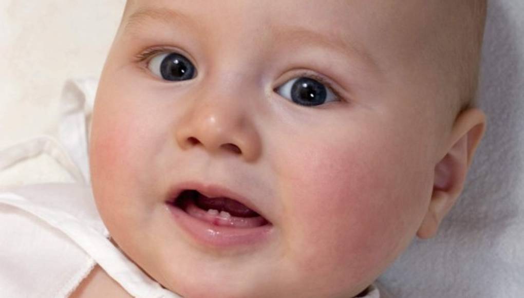 La dentición pone de mal humor a los bebés