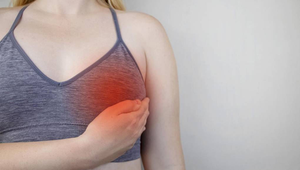 ¿Qué debes hacer si sufres de mastitis?