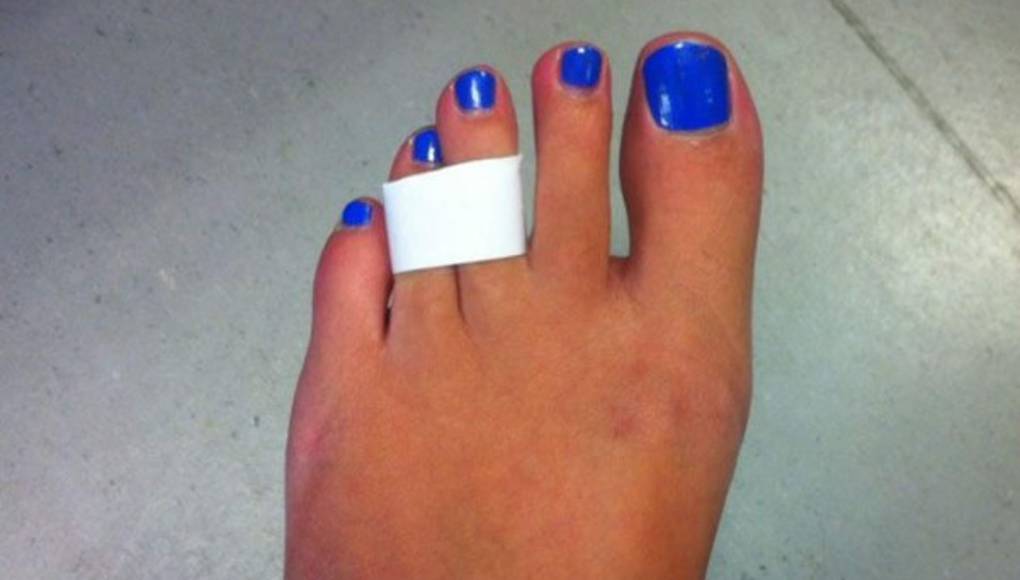 El esparadrapo, el mejor modo de proteger a los pies de las ampollas