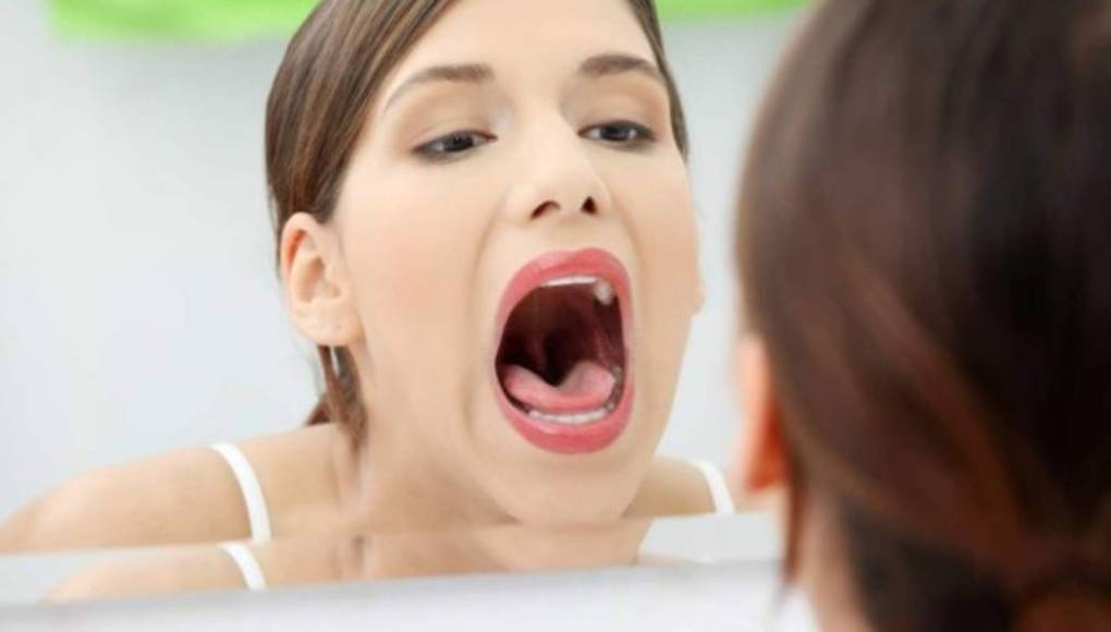 Lengua blanca: principales causas y qué hacer