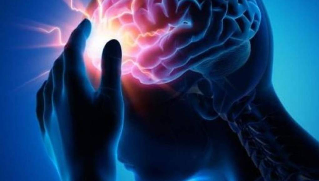 Cinco pasos para prevenir un ataque cerebral