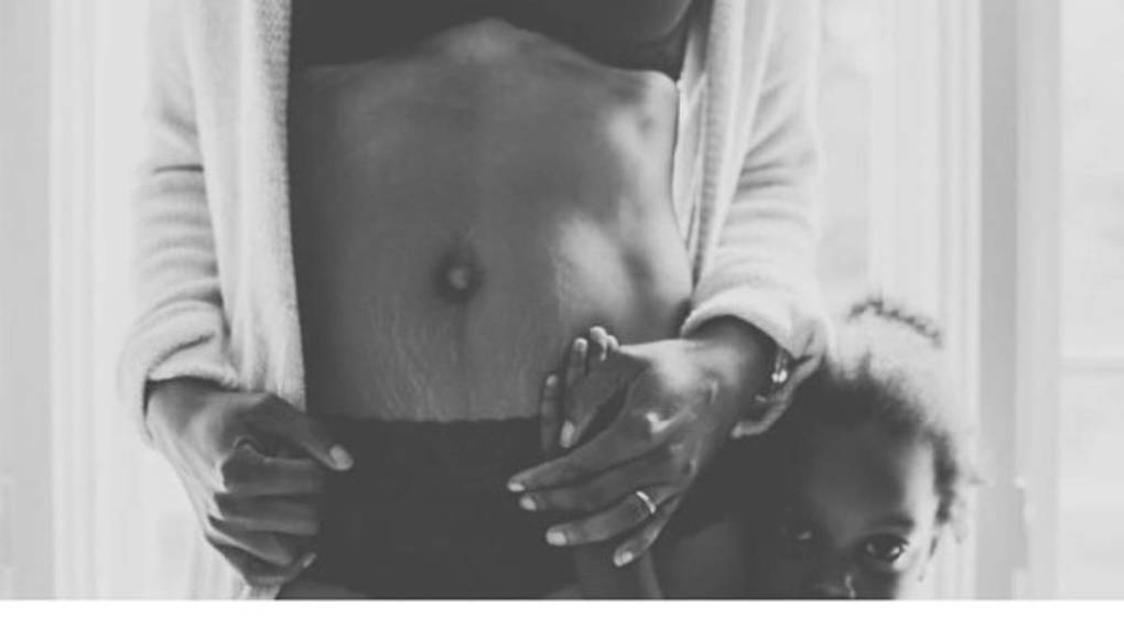 Mujeres comparten fotos de sus estrías para campaña viral