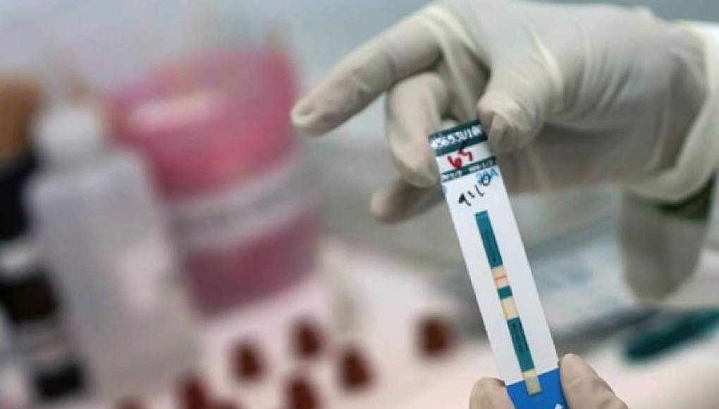 Reportan segundo paciente curado del virus de sida en el mundo