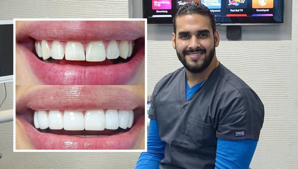 Juan Luis Liranzo comparte 3 consejos que si funcionan para que mejores tu estética dental