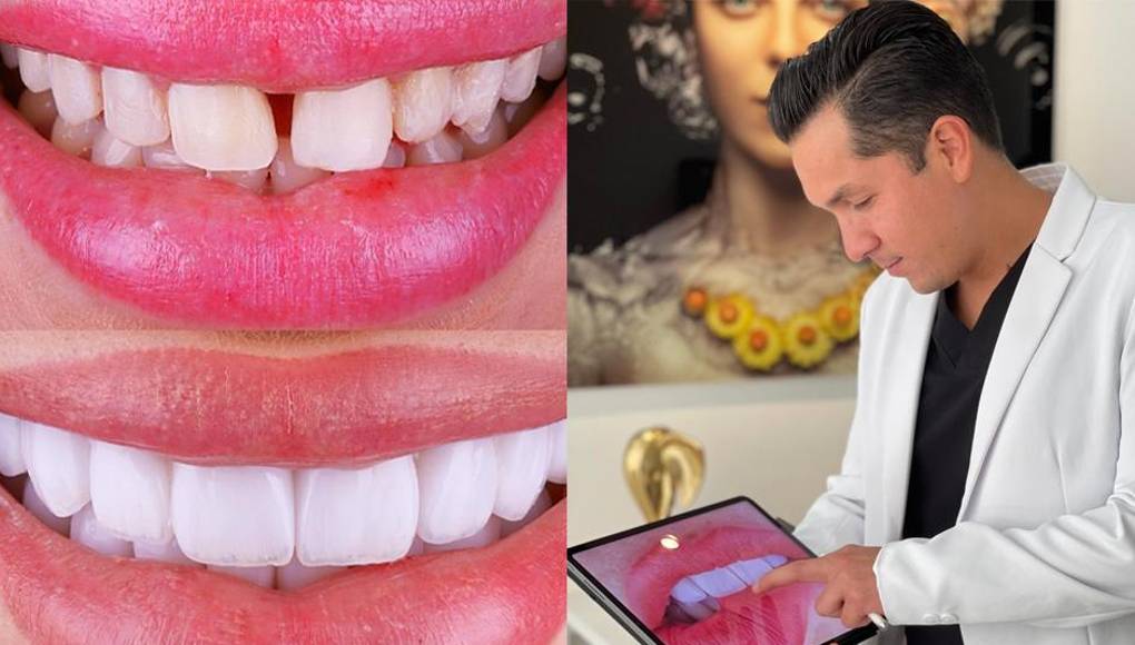 Tecnología y experiencia, claves para un buen diseño de sonrisa según Álamo Rodríguez