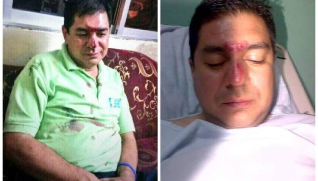 Director de Casa Alianza en Honduras denuncia supuesta golpiza por policías