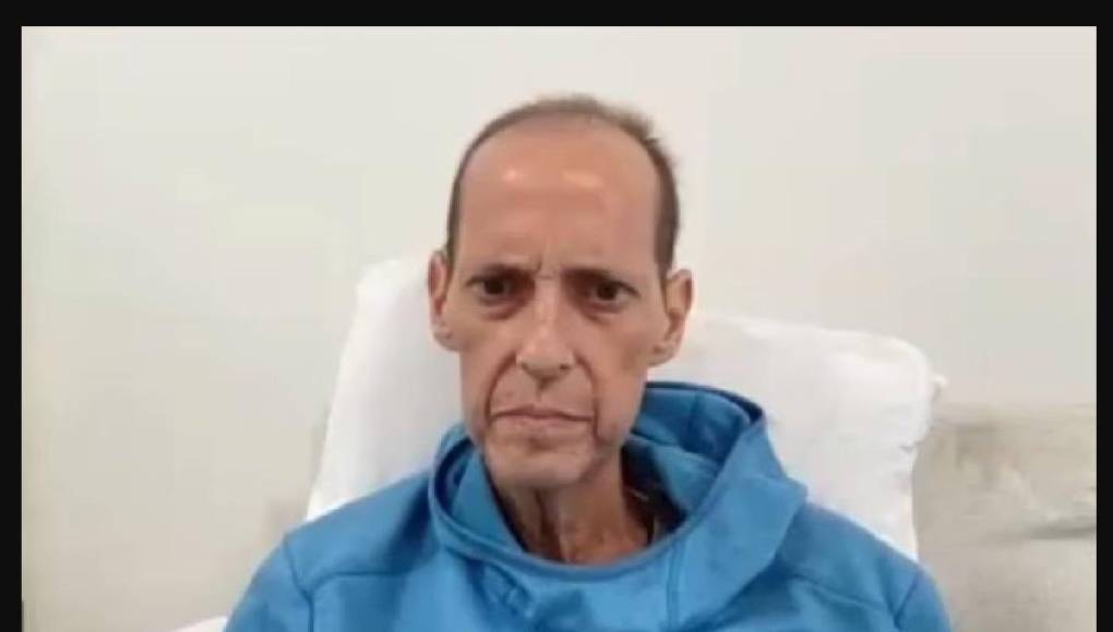 Paco Villa quedó muy afectado debido a su batalla con el cáncer.