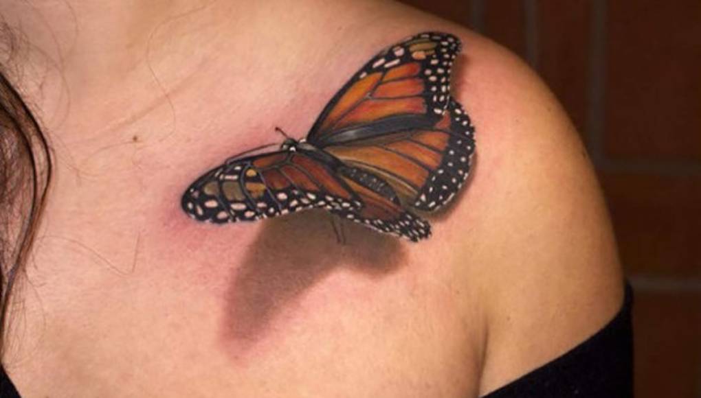 Se arrepiente de haberse tatuado? Lo que necesita saber sobre cómo borrarlo