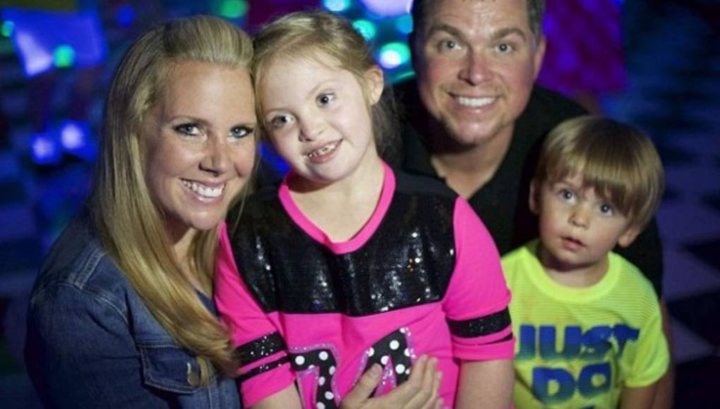 Hermosa modelo con síndrome de Down