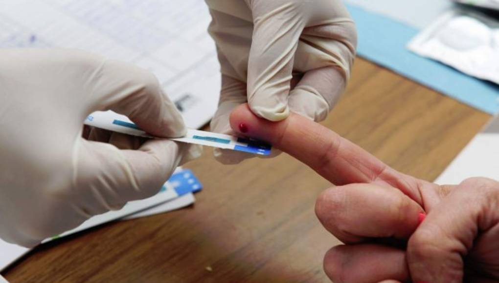 Lo que debes saber sobre el VIH/sida