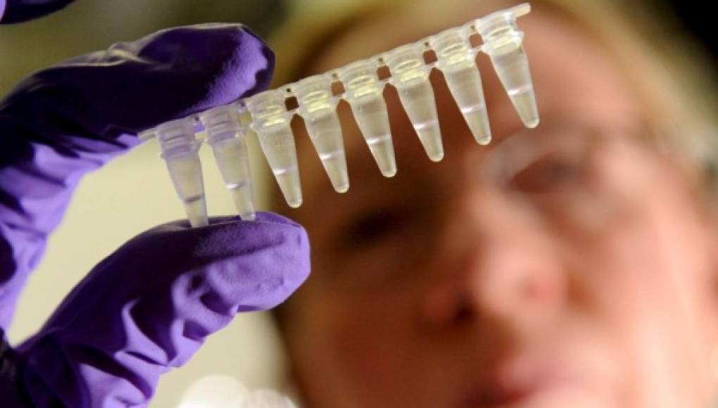 Nuevo método 'más sensible' de detección oral del VIH