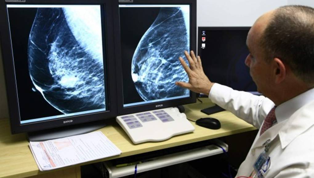 La mamografía en 3D es más clara