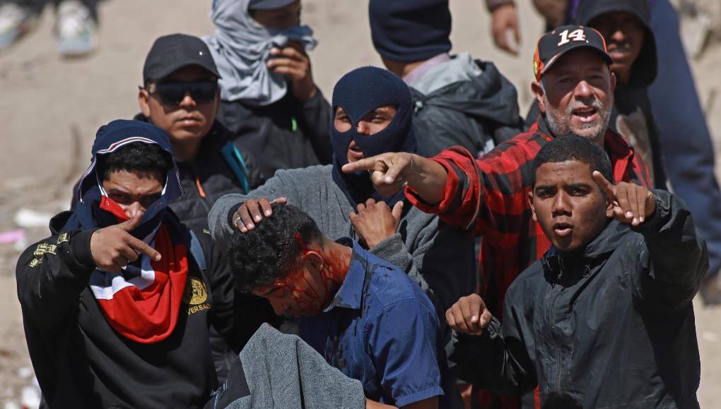  Migrantes auxilian a un compañero herido en las inmediaciones del la frontera con Estados Unidos. 