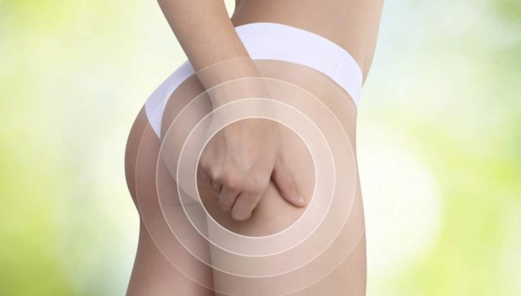 Los sí y no para combatir a diario la celulitis  