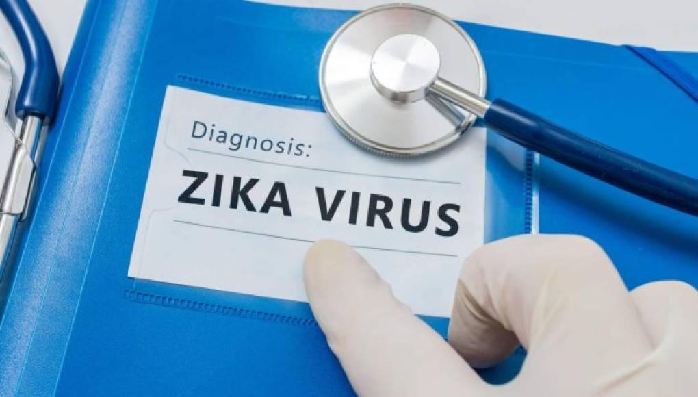 El zika podría permanecer en el semen un periodo más corto del que se creía, según un estudio