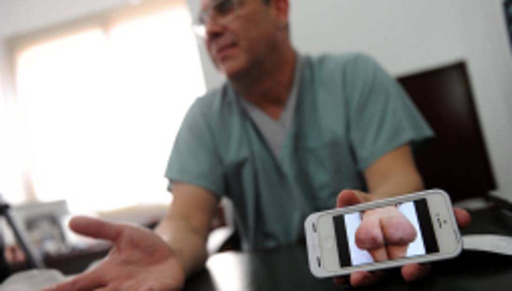 Venezolanas viven una tragedia por querer un trasero grande