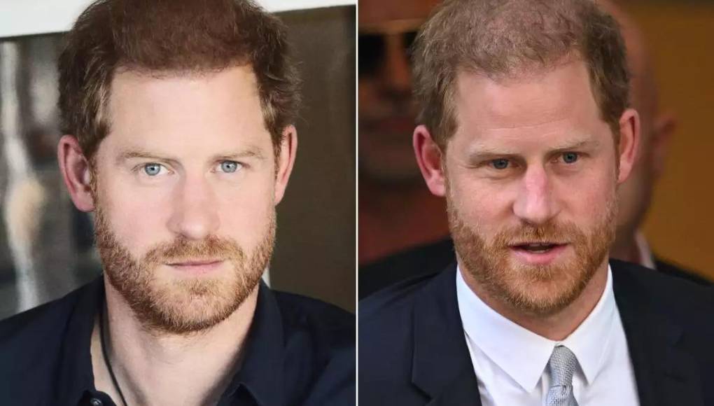 El príncipe Harry también fue acusado del uso de photoshop, ya que en una imagen del sitio oficial de Better Up, del que es consejero, aparece con bastante cabello para disimular su cada vez más pronunciada calvicie.