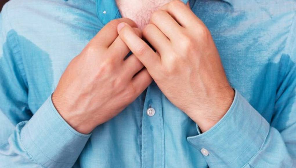 Un exceso de sudor puede provocar un sufrimiento emocional en algunas personas