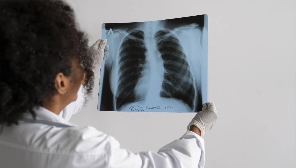 Fármaco de Pfizer contra tipo de cáncer de pulmón obtiene buenos resultados en ensayos