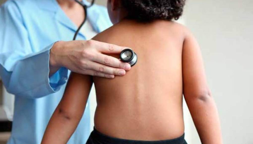 Cada 39 segundos, un niño menor de 5 años muere de neumonía en el mundo