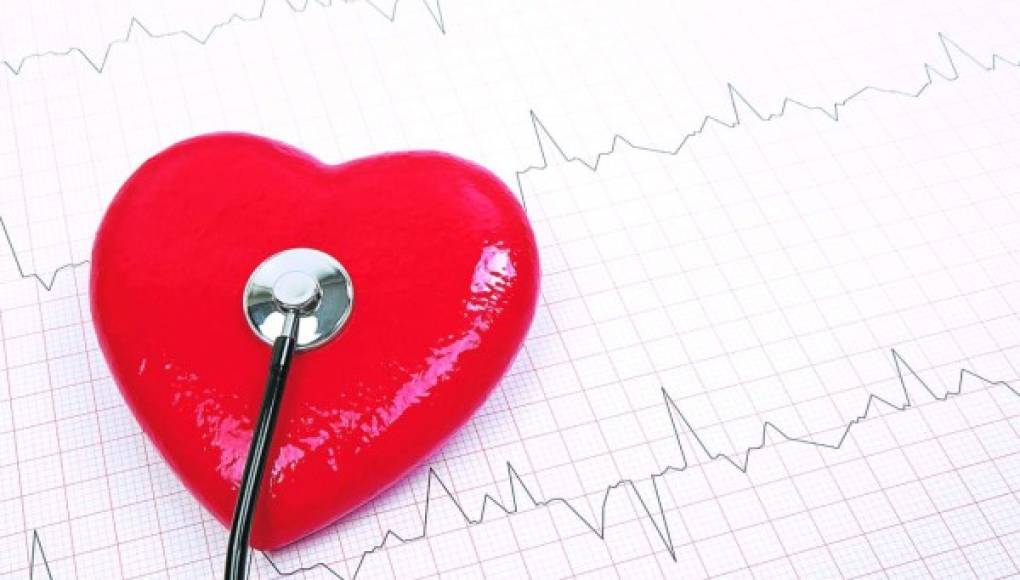 Las arritmias cardiacas deben tratarse para evitar una embolia