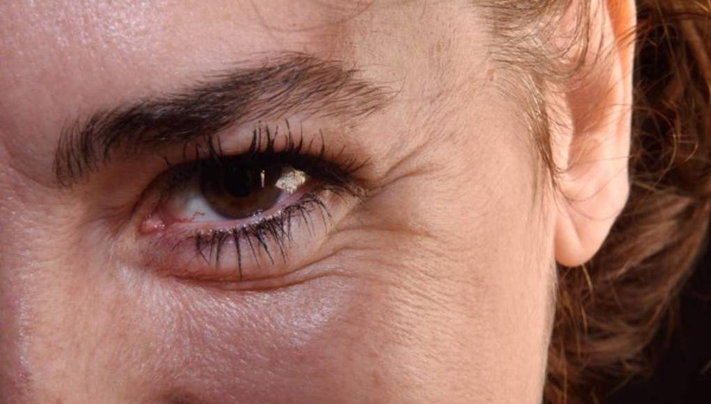 Los científicos acaban con las arrugas y la pérdida de pelo de los ratones