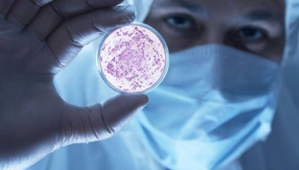 Hallan nuevo mecanismo para bloquear el Sida