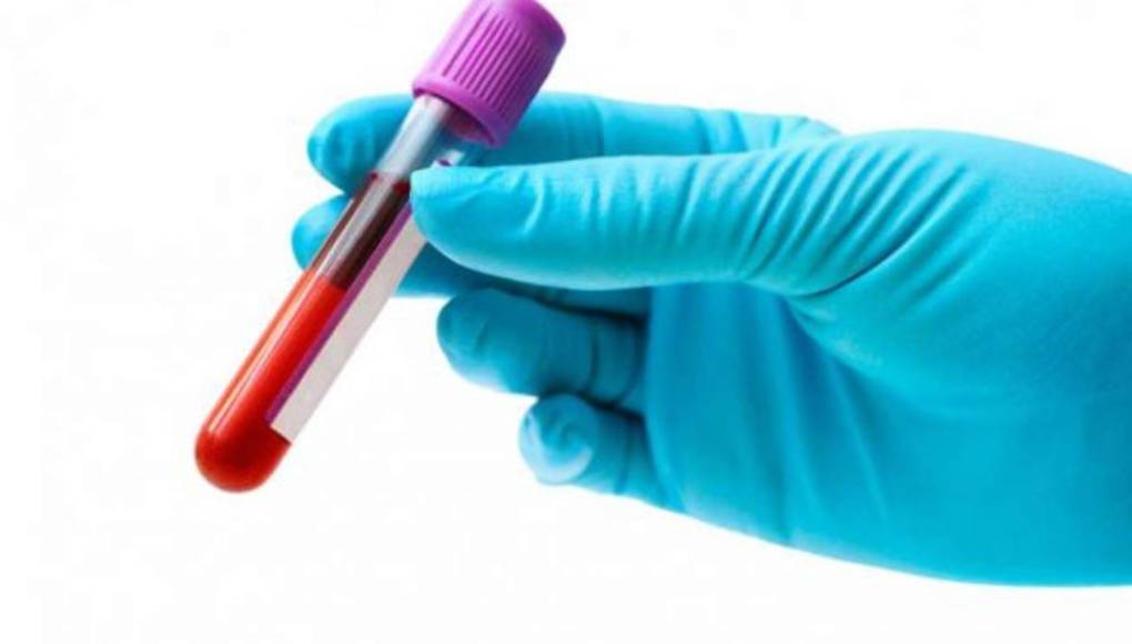 El plasma, rico en plaquetas rejuvenece la piel y se usa en la medicina