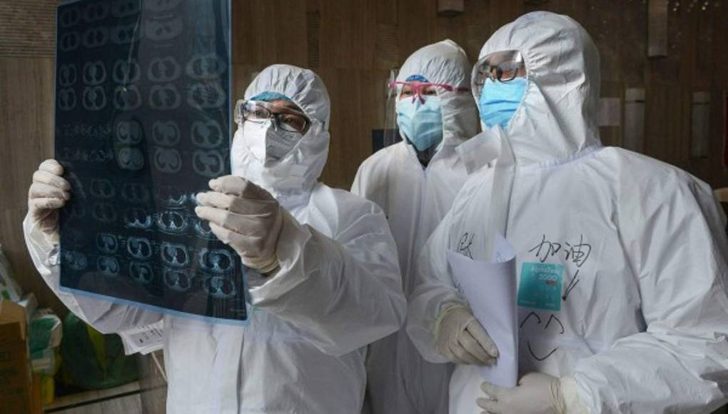 Nueva información sobre cómo la covid-19 daña al cerebro