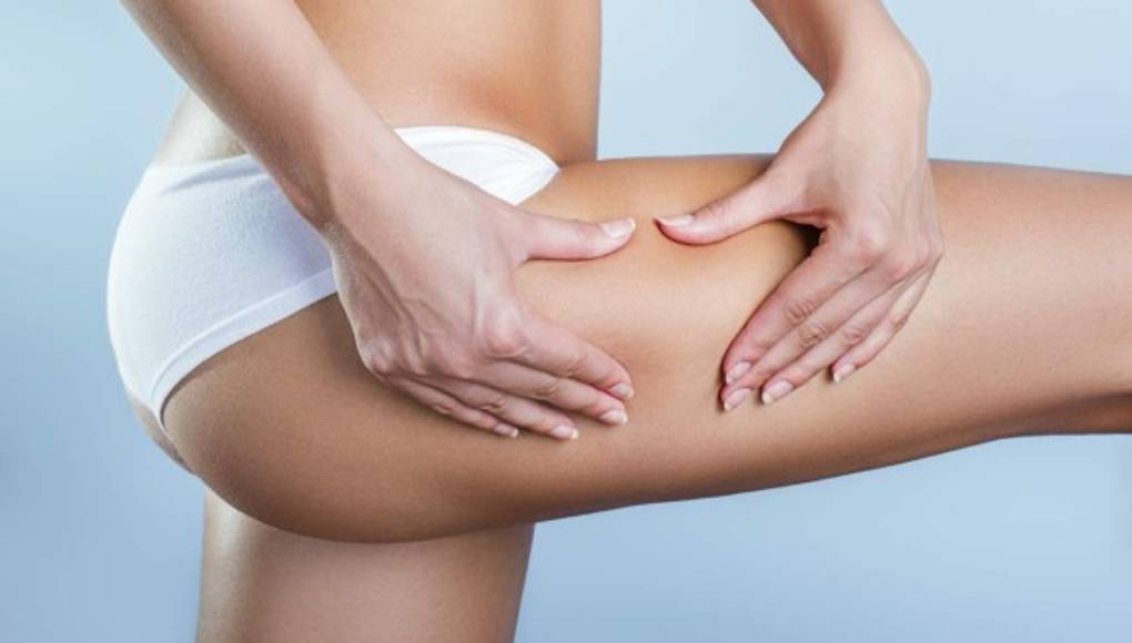 La piel de naranja se combate con ejercicio y comiendo bien