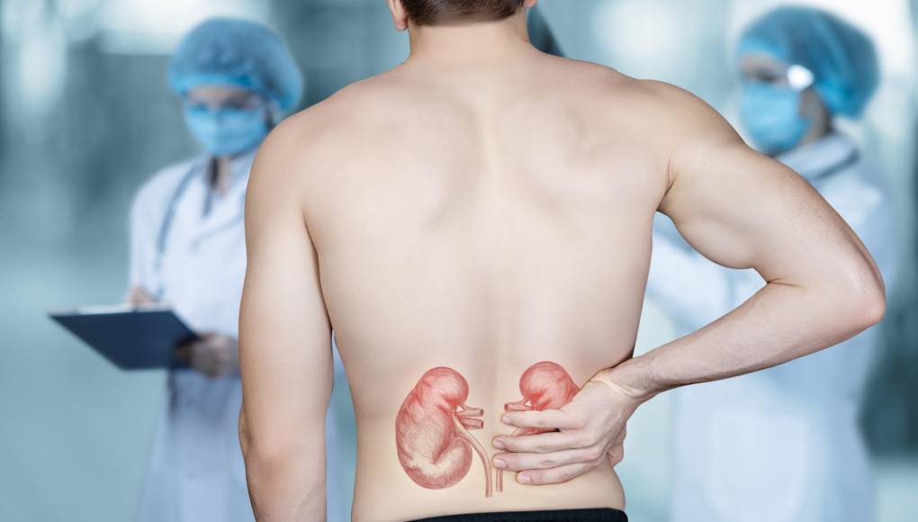 ¿Qué es la enfermedad renal y cómo prevenirla?