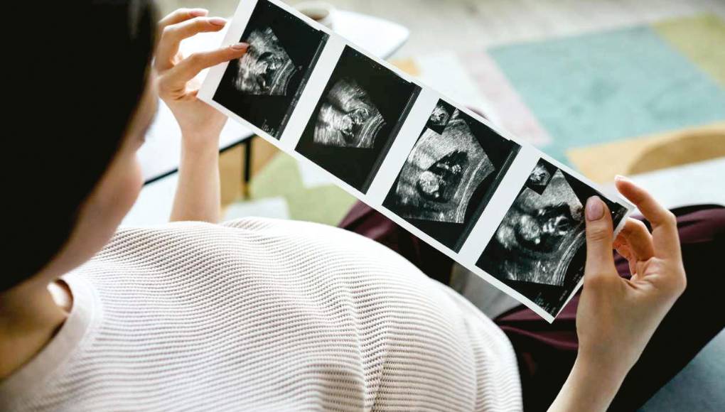 Cómo tener un embarazo conmente sana